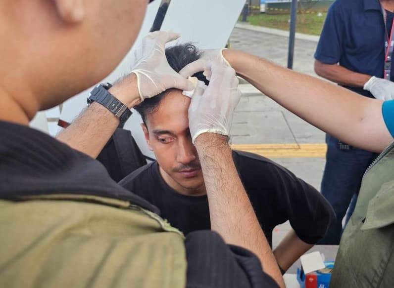 Anggota dari bagian Humas yang bertugas dengan pakaian sipil turut menjadi korban setelah terkena lemparan batu di bagian jidat. (Foto: Herdi/Pusaranmedia.com)