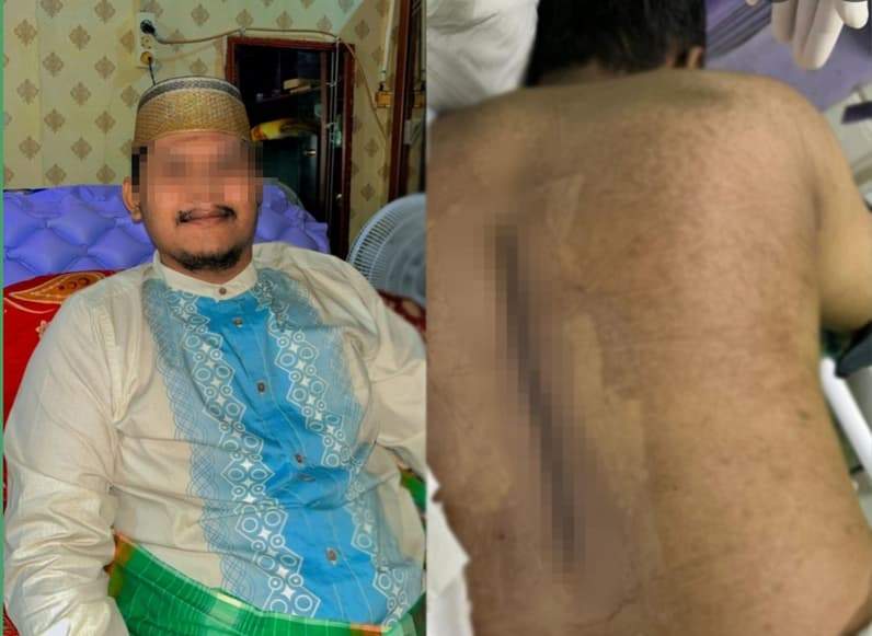 Perusahaan outsourcing jasa pengamanan di Unmul, dilaporkan ke Disnaker Kota Samarinda atas dugaan menghilangkan hak seorang karyawannya yang tengah mengalami sakit Tumor Jinak. (Foto: Denis Kakak Korban)